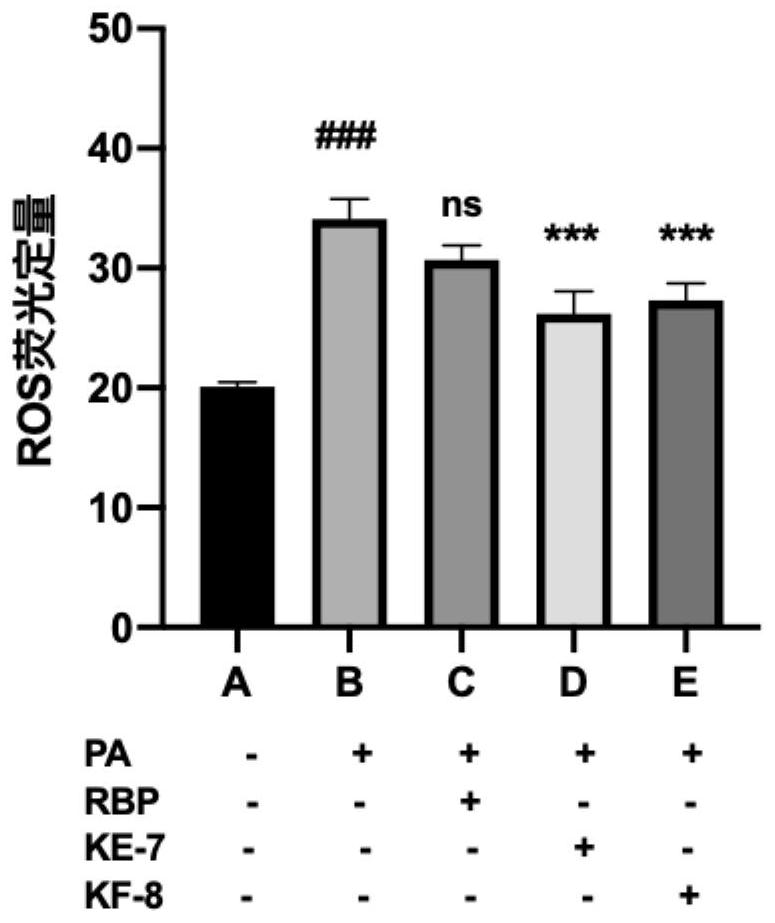 Application of rice bran active peptide in prevention or treatment of lipotoxicity related diseases