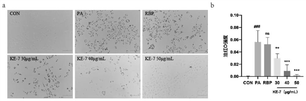 Application of rice bran active peptide in prevention or treatment of lipotoxicity related diseases