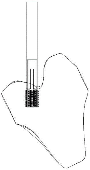 Integrated manufacturing method of a novel composite ligament-bone scaffold