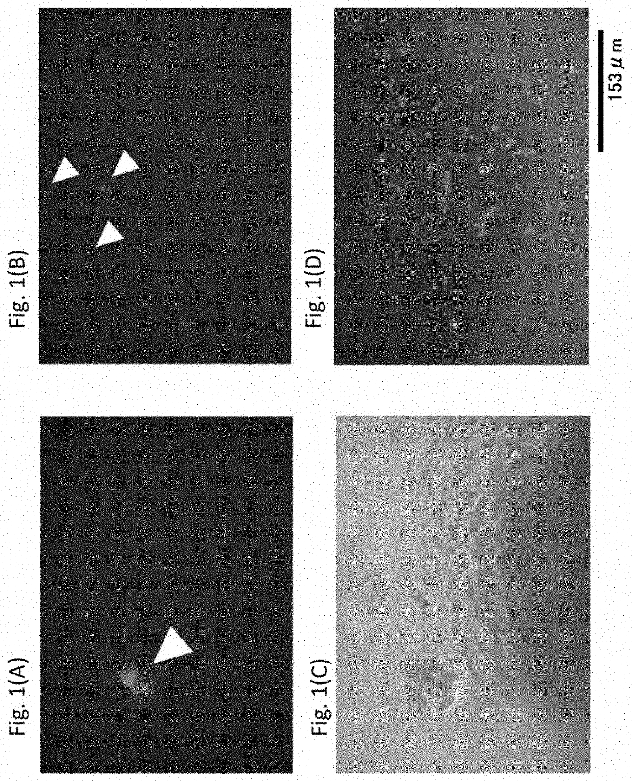 Immortalized sweat gland myoepithelial cell