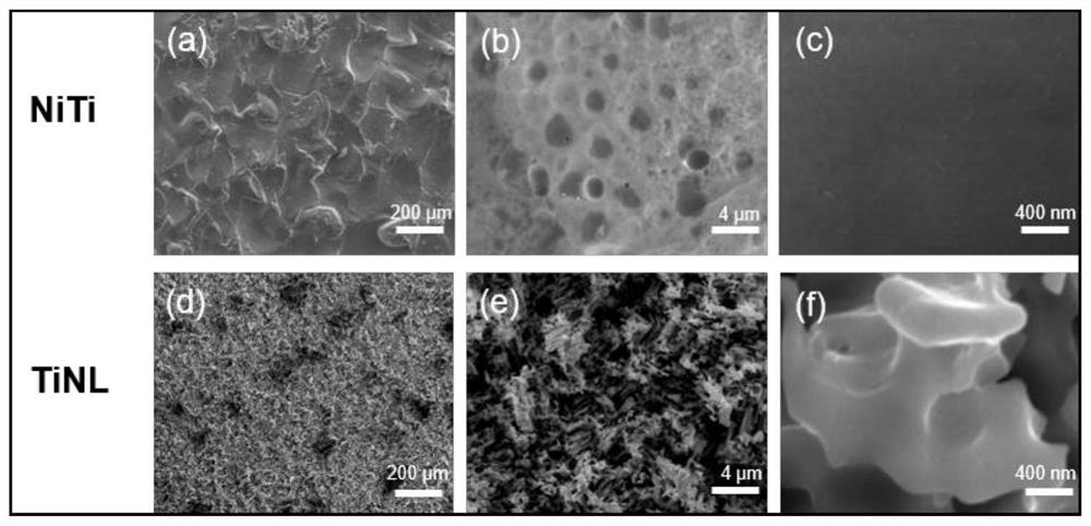 Medical nickel-titanium alloy material with thermo-sensitive hydrogel coating as well as preparation method and application of medical nickel-titanium alloy material