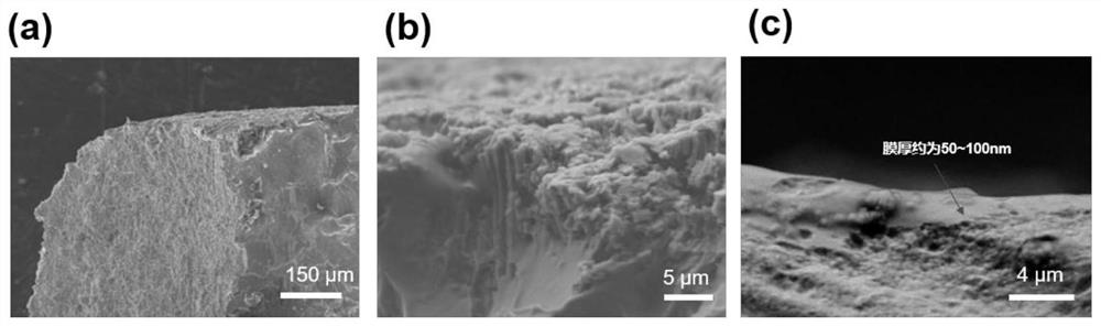 Medical nickel-titanium alloy material with thermo-sensitive hydrogel coating as well as preparation method and application of medical nickel-titanium alloy material