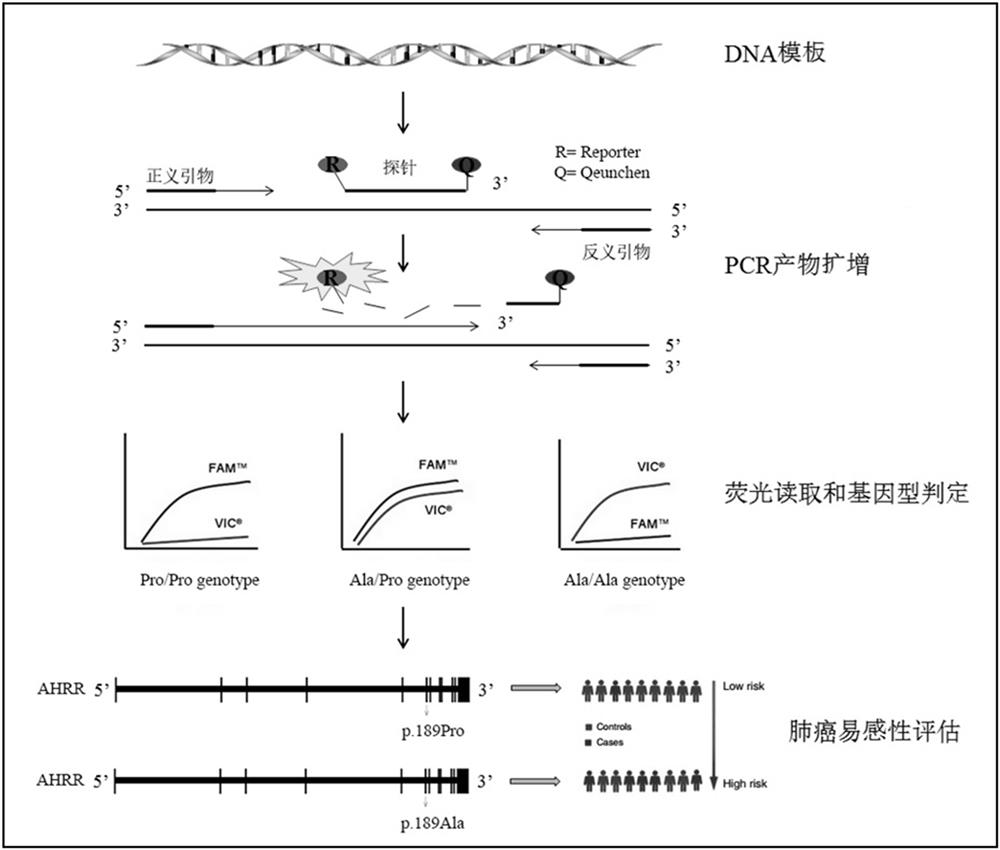 A primer set for detecting p.pro189ala locus genotype and its detection kit and application