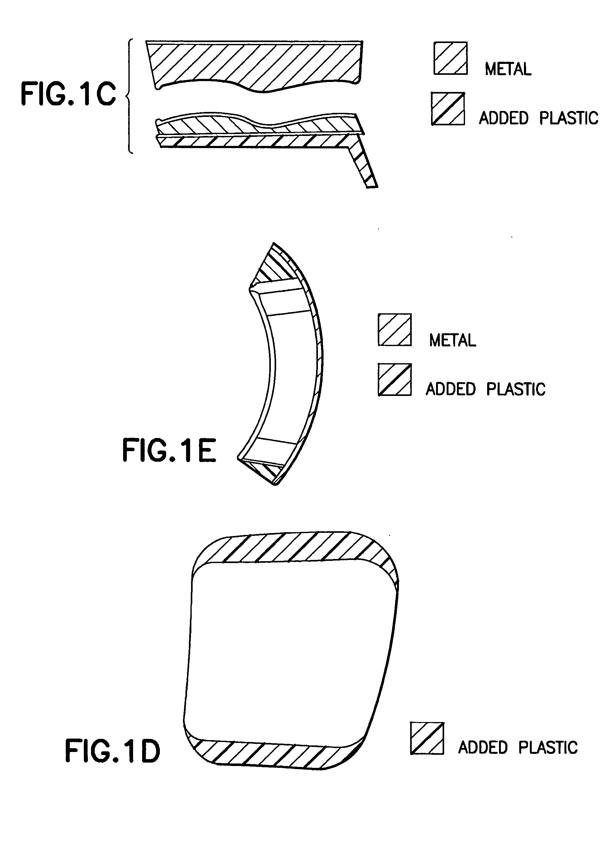 Ankle prosthesis and method for implanting ankle prosthesis
