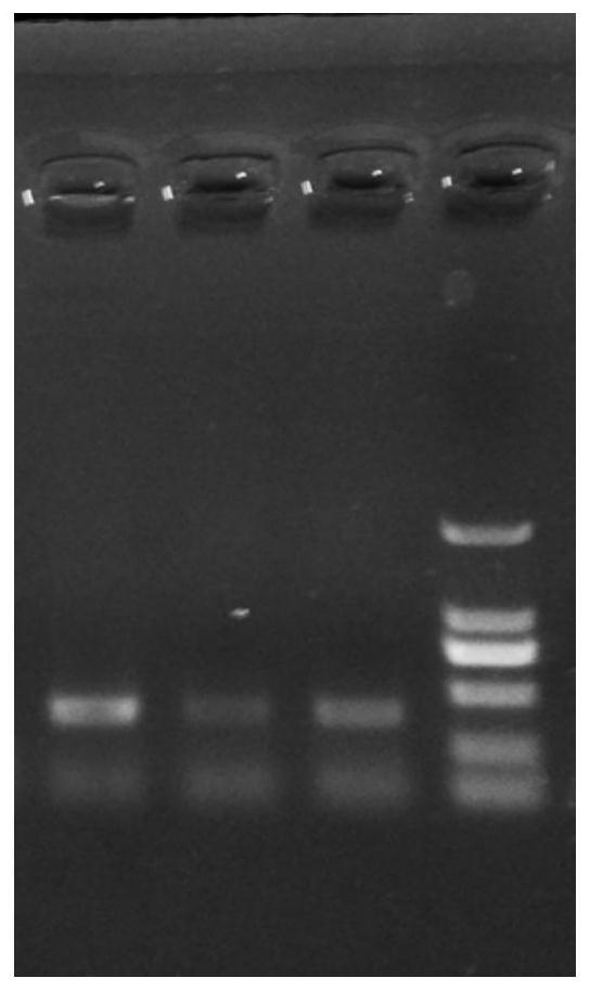 Method and composition for building HBV transgenic mouse model, and applications of HBV transgenic mouse model