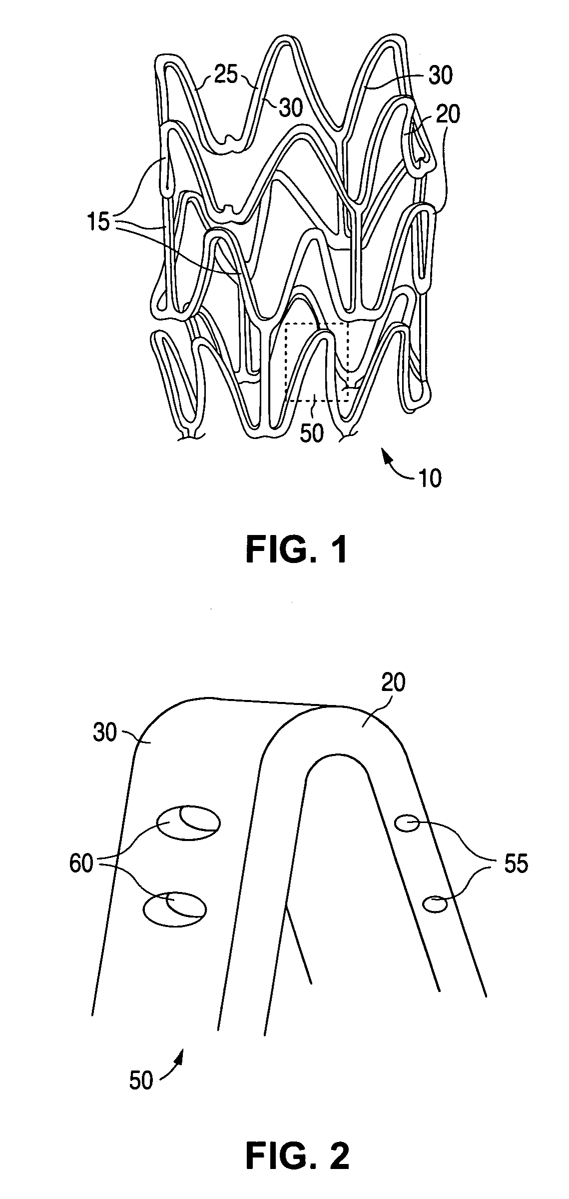 Anti-proliferative and anti-inflammatory agent combination for treatment of vascular disorders with an implantable medical device
