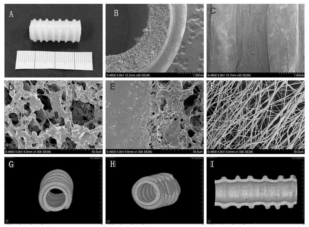 Elastic degradable tracheal stent and its construction method
