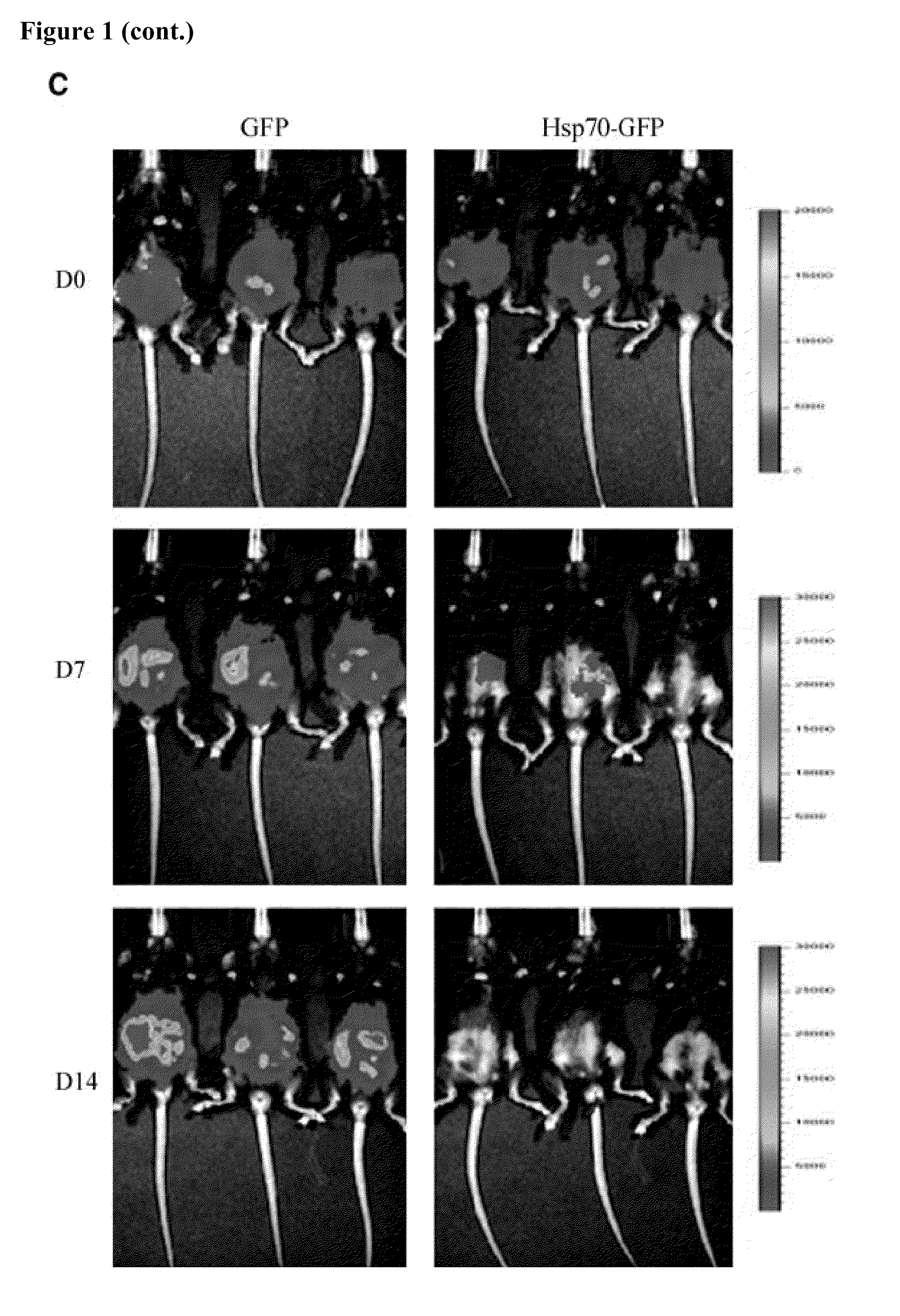 Tumor cell-based cancer immunotherapeutic compositions and methods