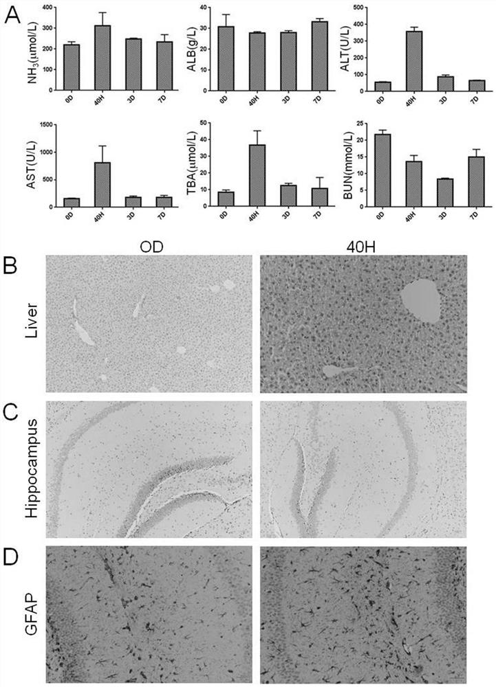 Application of FXR agonist in treatment of hepatic encephalopathy