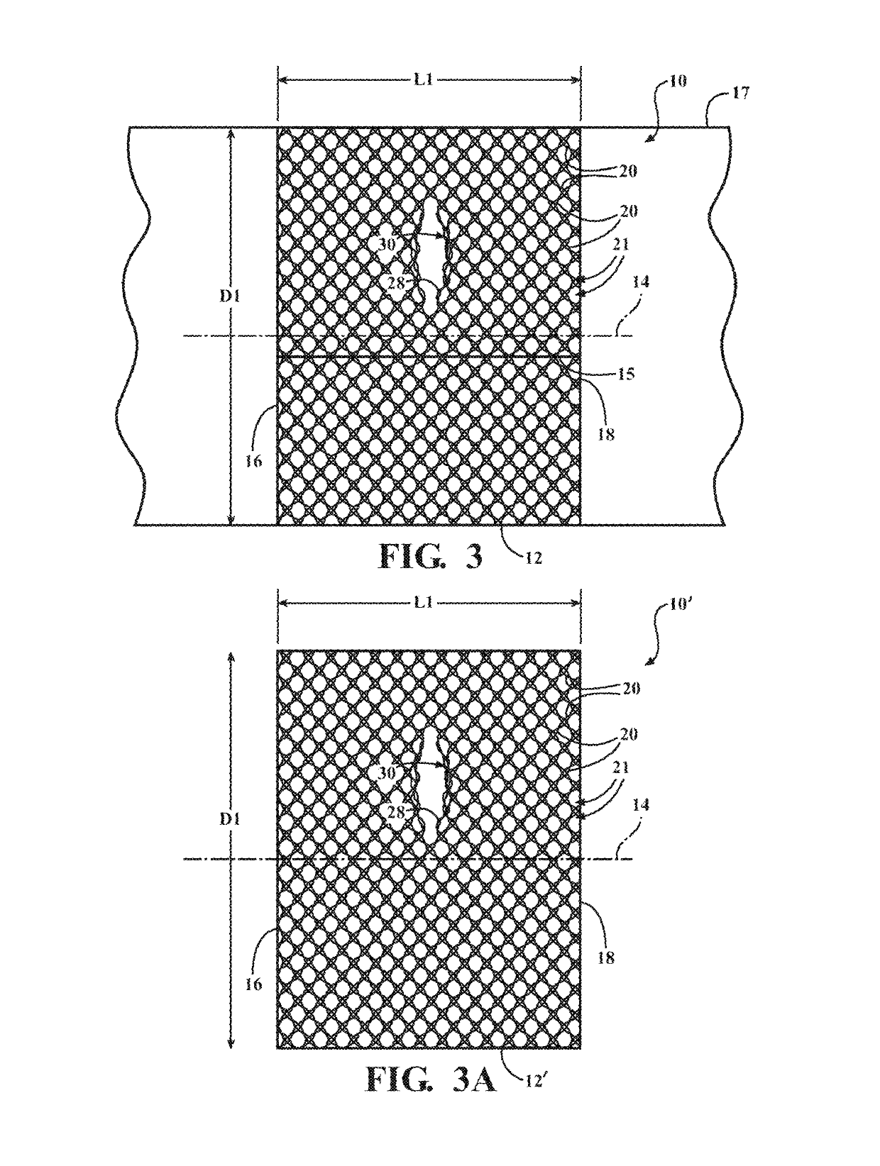 Braided textile sleeve with integrated opening and self-sustaining expanded and contracted states and method of construction thereof
