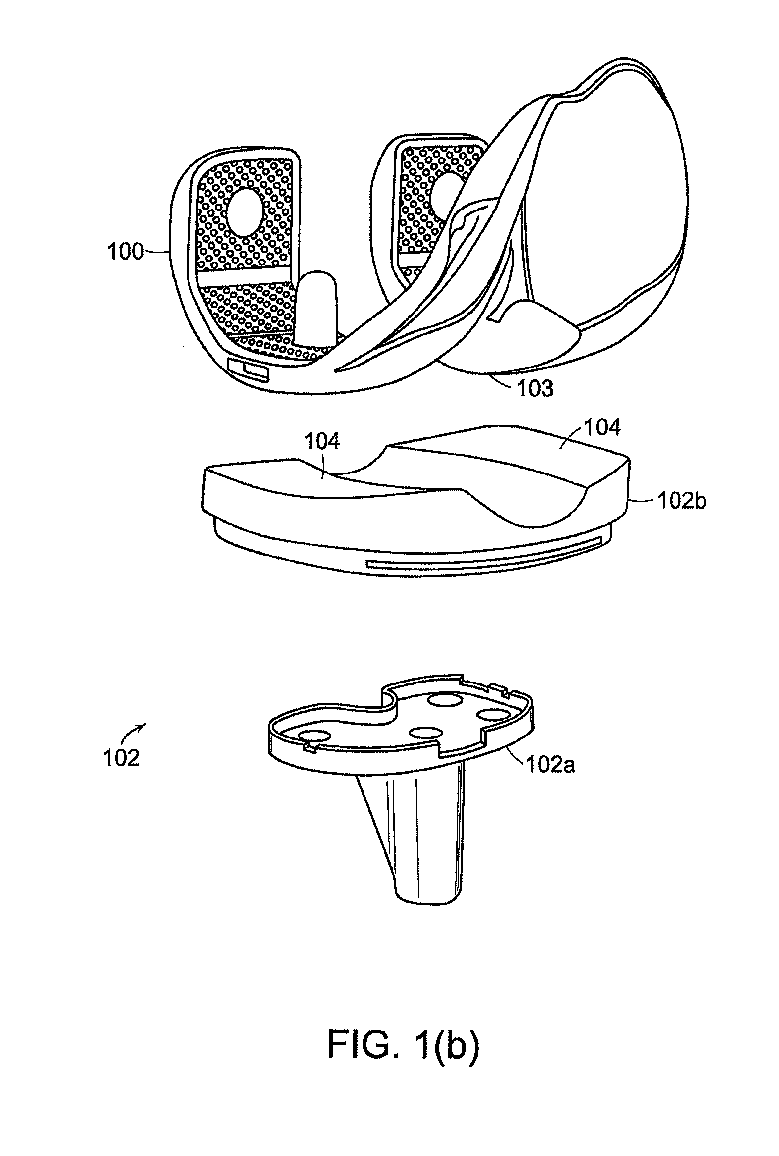 Implant Planning Using Captured Joint Motion Information