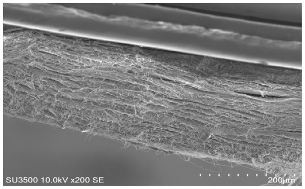 Preparation method of shell-core structure nanofiber membrane containing antibacterial peptide