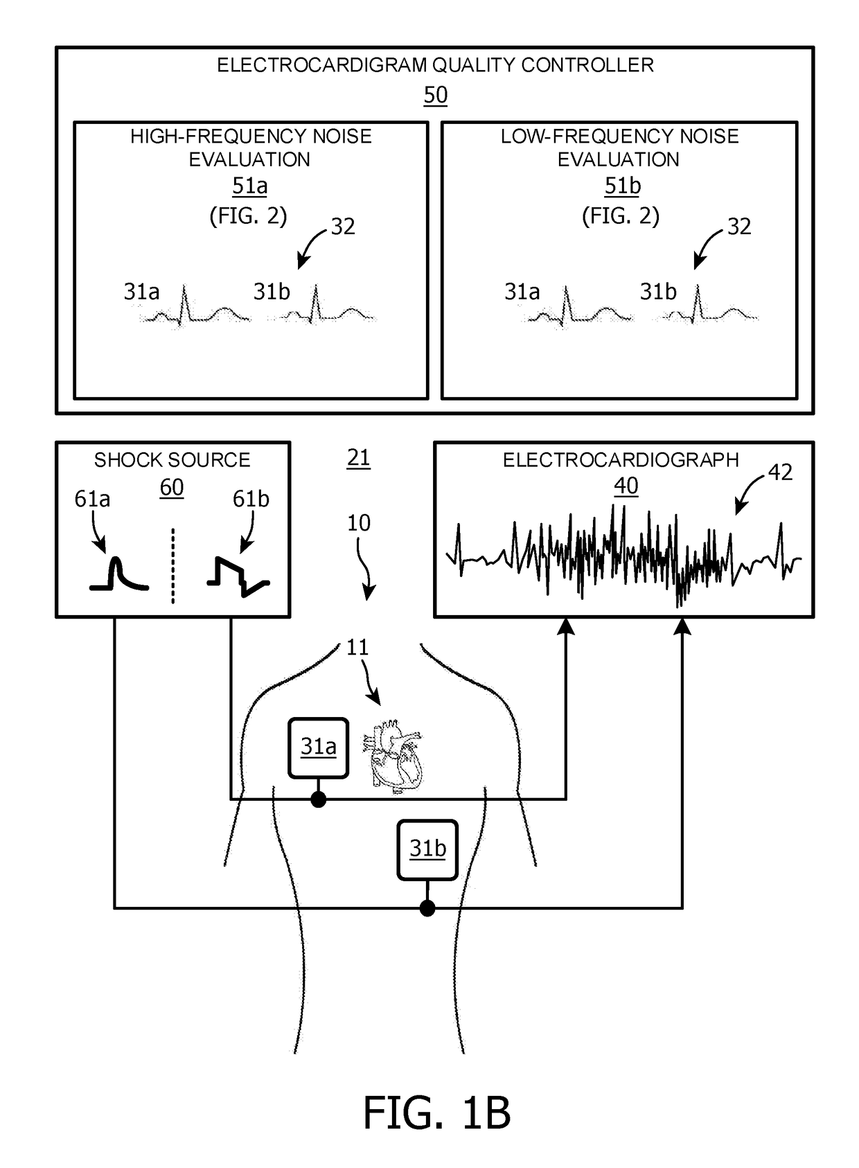High/low frequency signal quality evaluations of ECG lead signals