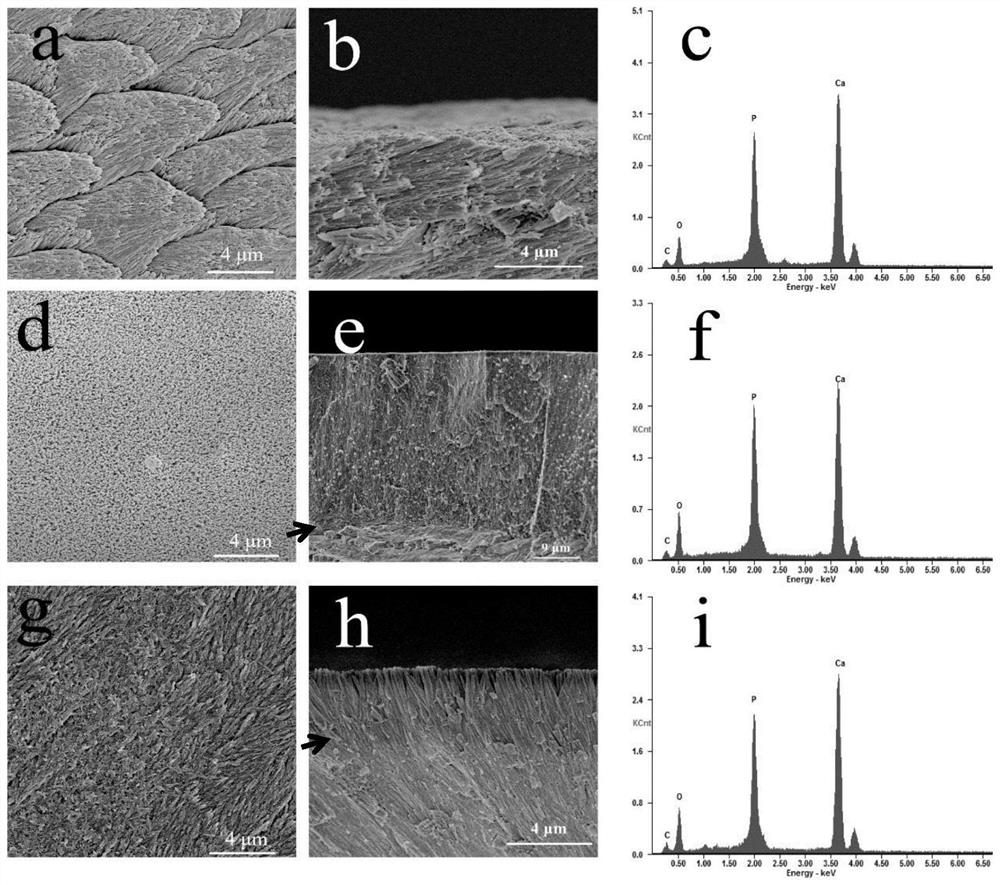 Mineralized material for treating tooth sensitivity and promoting epitaxial growth of enamel and application of mineralized material