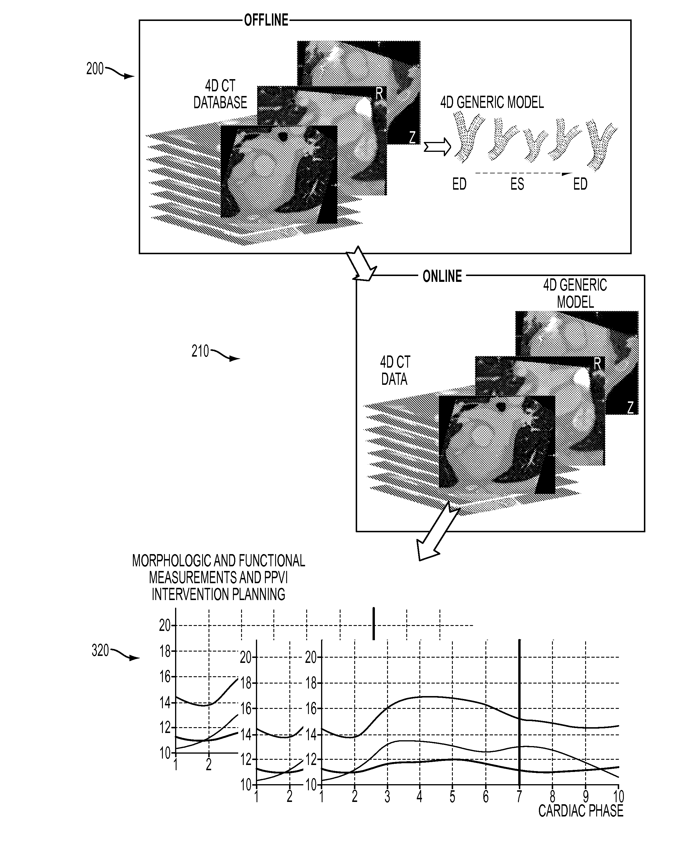Method and System for Dynamic Pulmonary Trunk Modeling and Intervention Planning