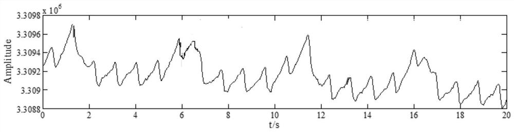 Respiratory rate detection method and device and medical equipment