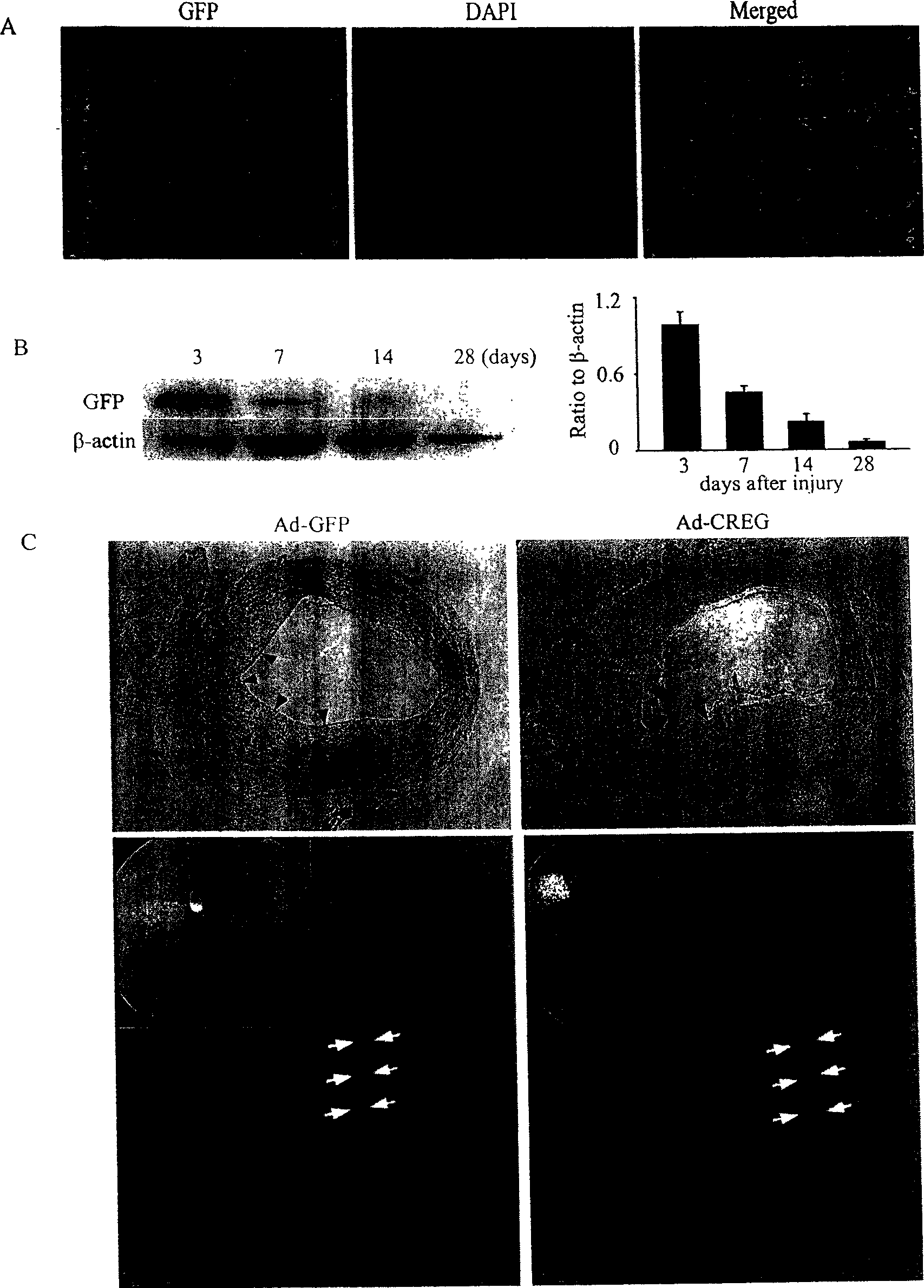 Recombinant adenovirus for expressing human CREG and uses thereof