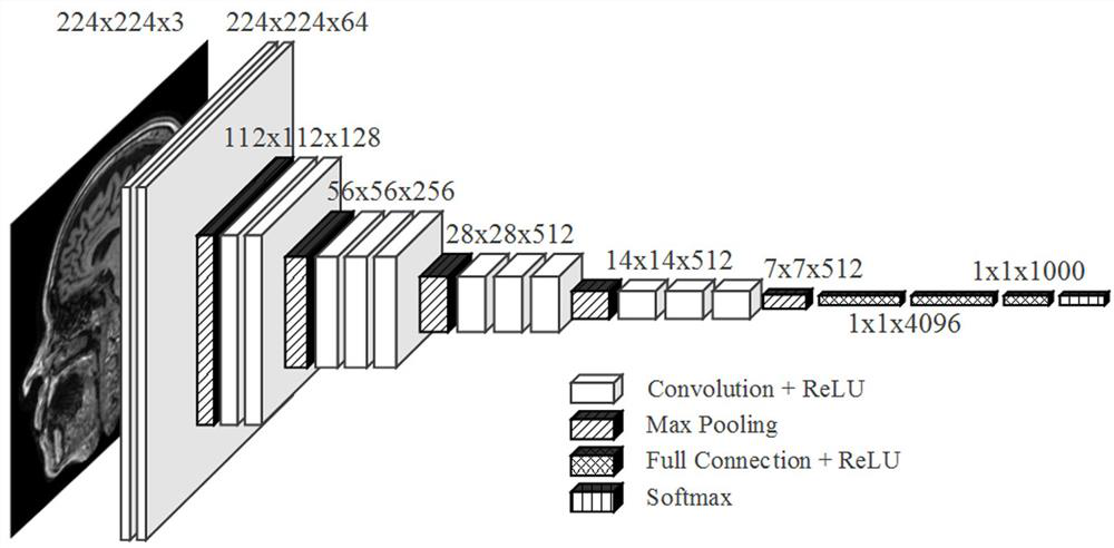 Alzheimer's disease classification method based on improved 3D CNN network