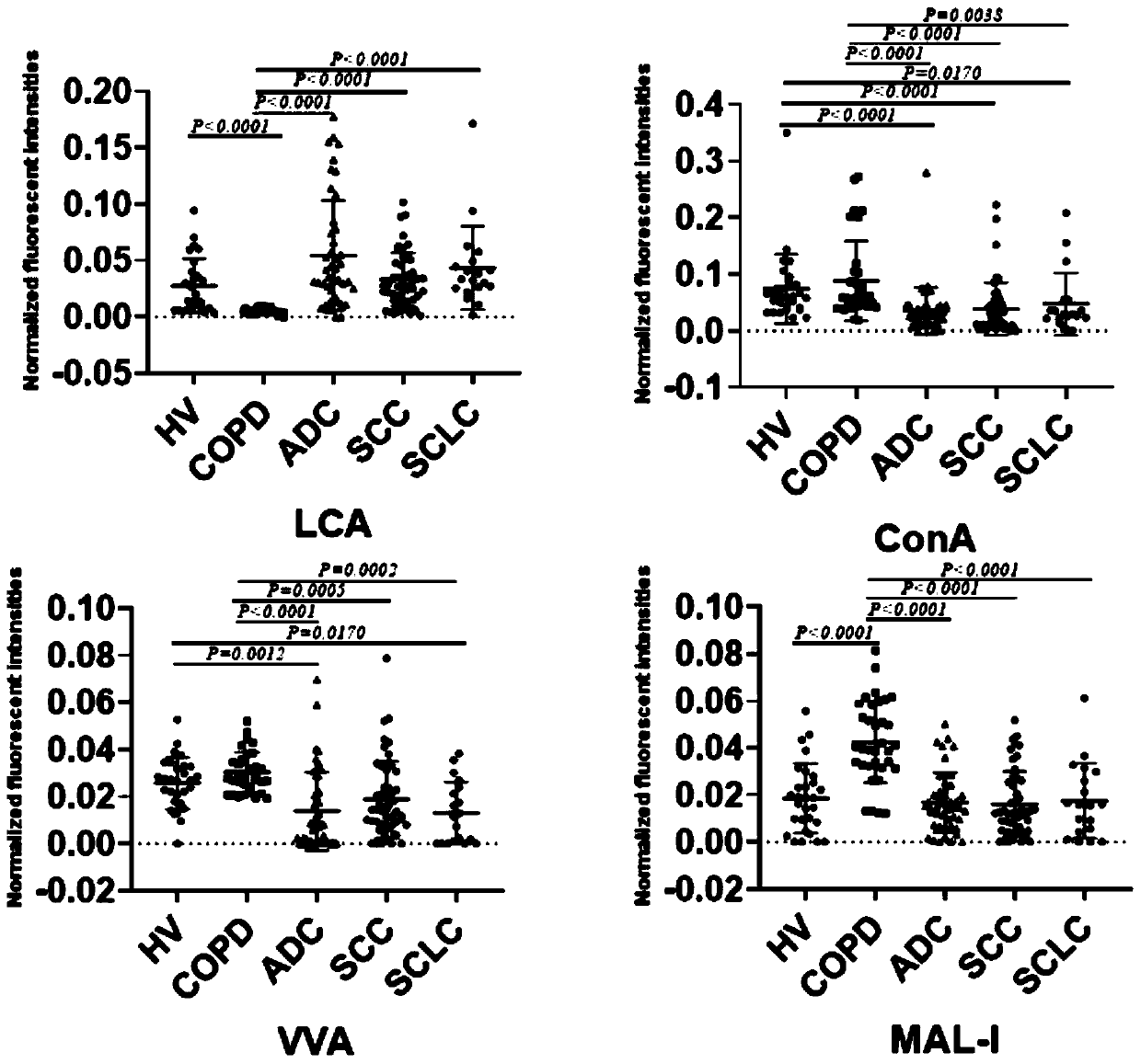 Application of specific lectin combination in construction of test tool for identifying adenocarcinoma in lung cancer based on saliva glycoprotein carbohydrate chains