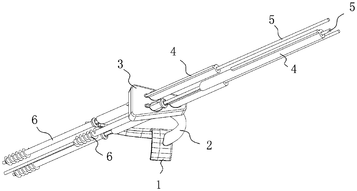 A three-dimensional reverse customized surgical navigator for femoral neck fracture