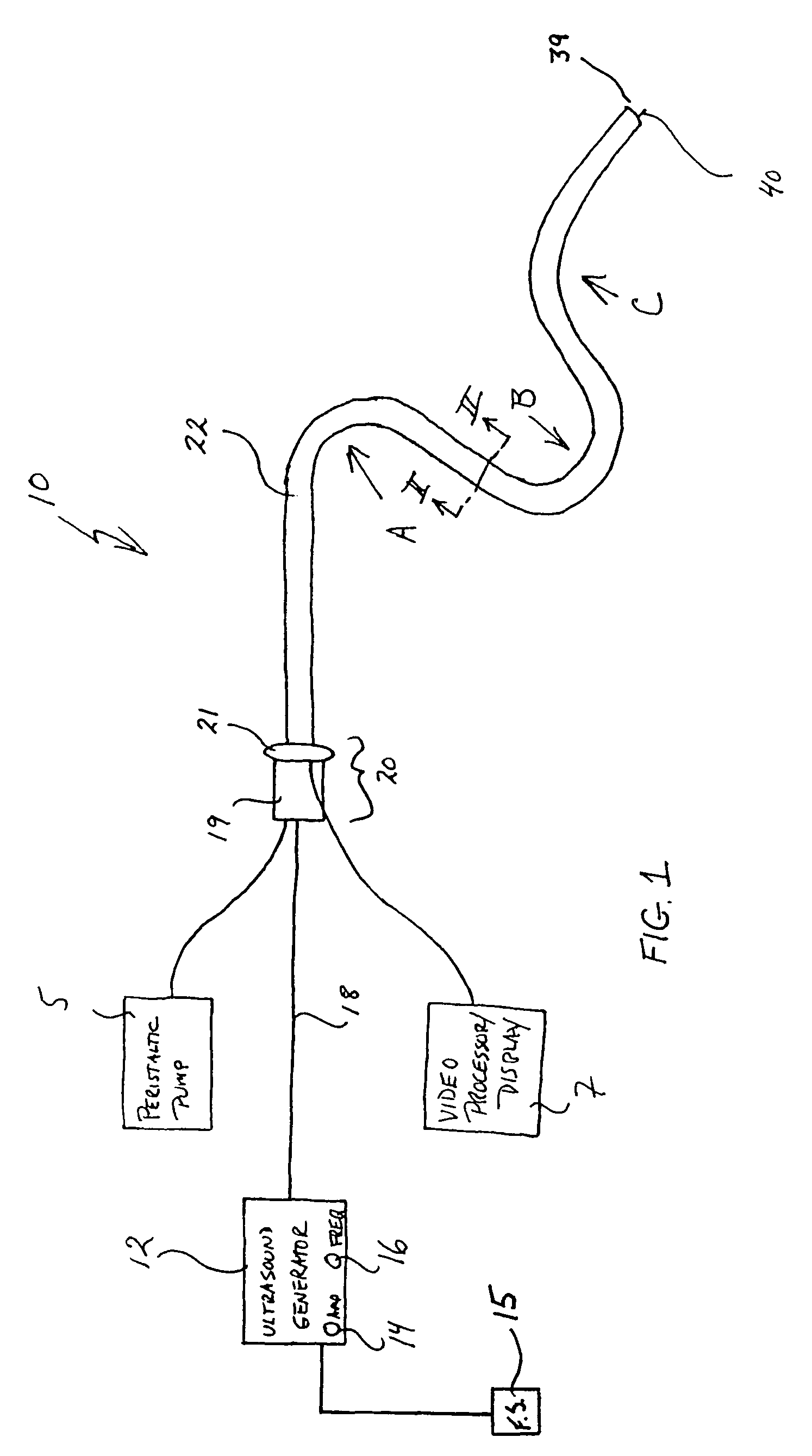 Flexible ultrasonic wire in an endoscope delivery system