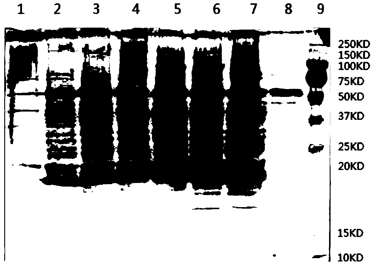 Method for producing HPV31 L1 protein by using hansenula polymorpha expression system