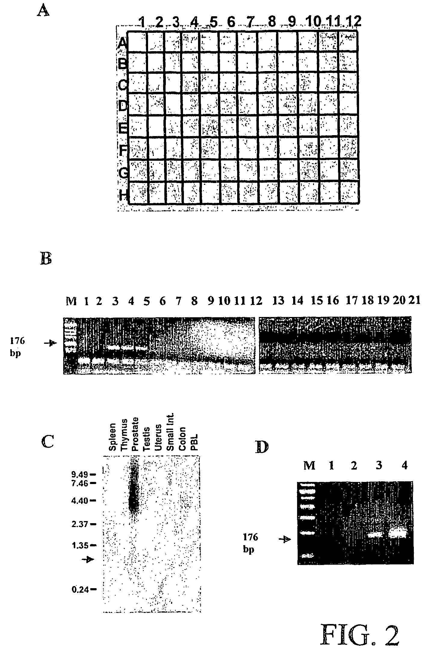 Gene expressed in prostate cancer and methods of use