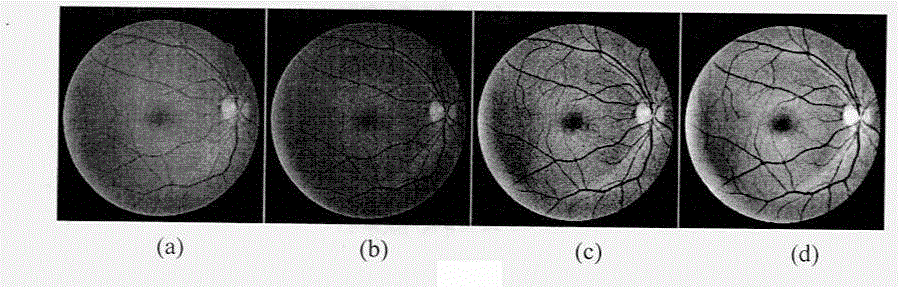 Fundus image vascular segmentation method based on phase congruency