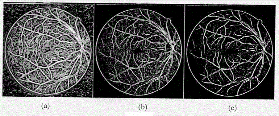 Fundus image vascular segmentation method based on phase congruency