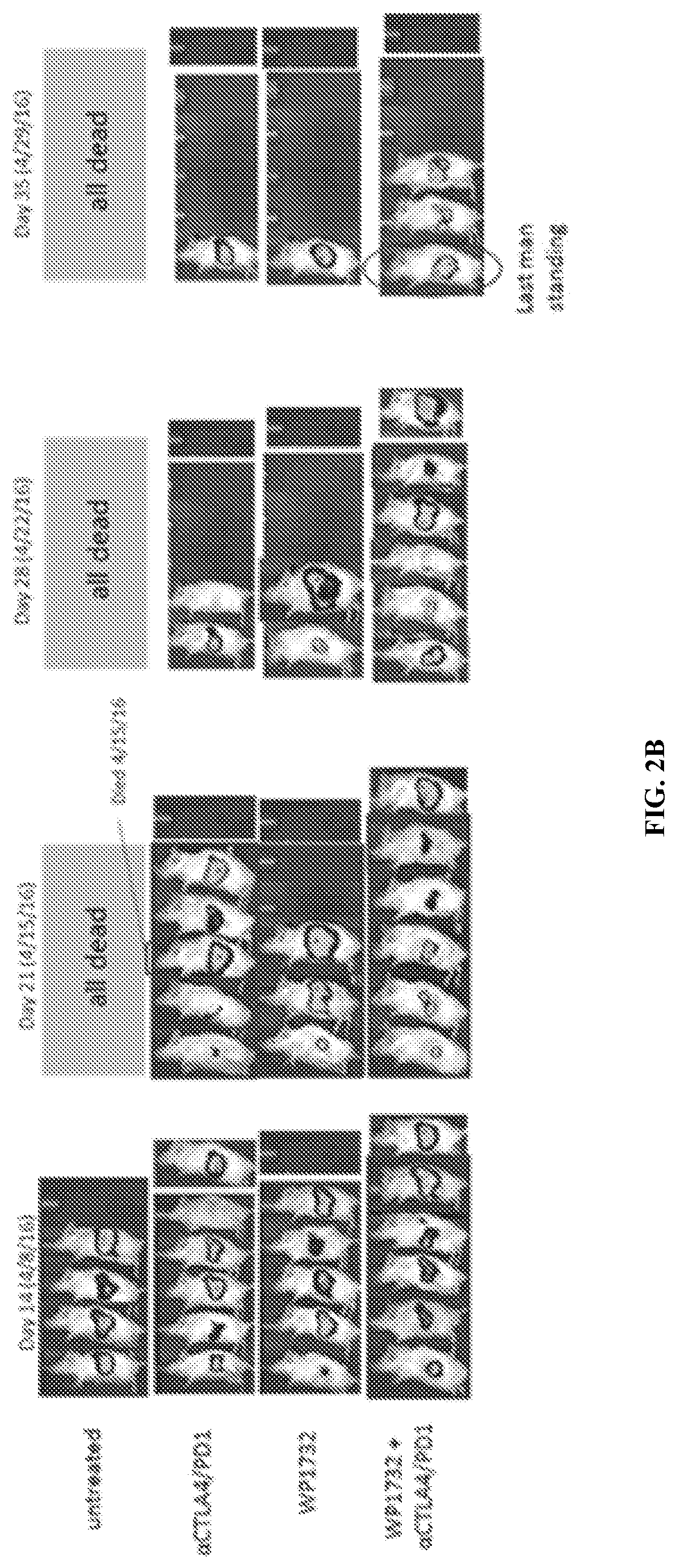 Combinations of transcription inhibitors and immune checkpoint inhibitors for treatment of disease