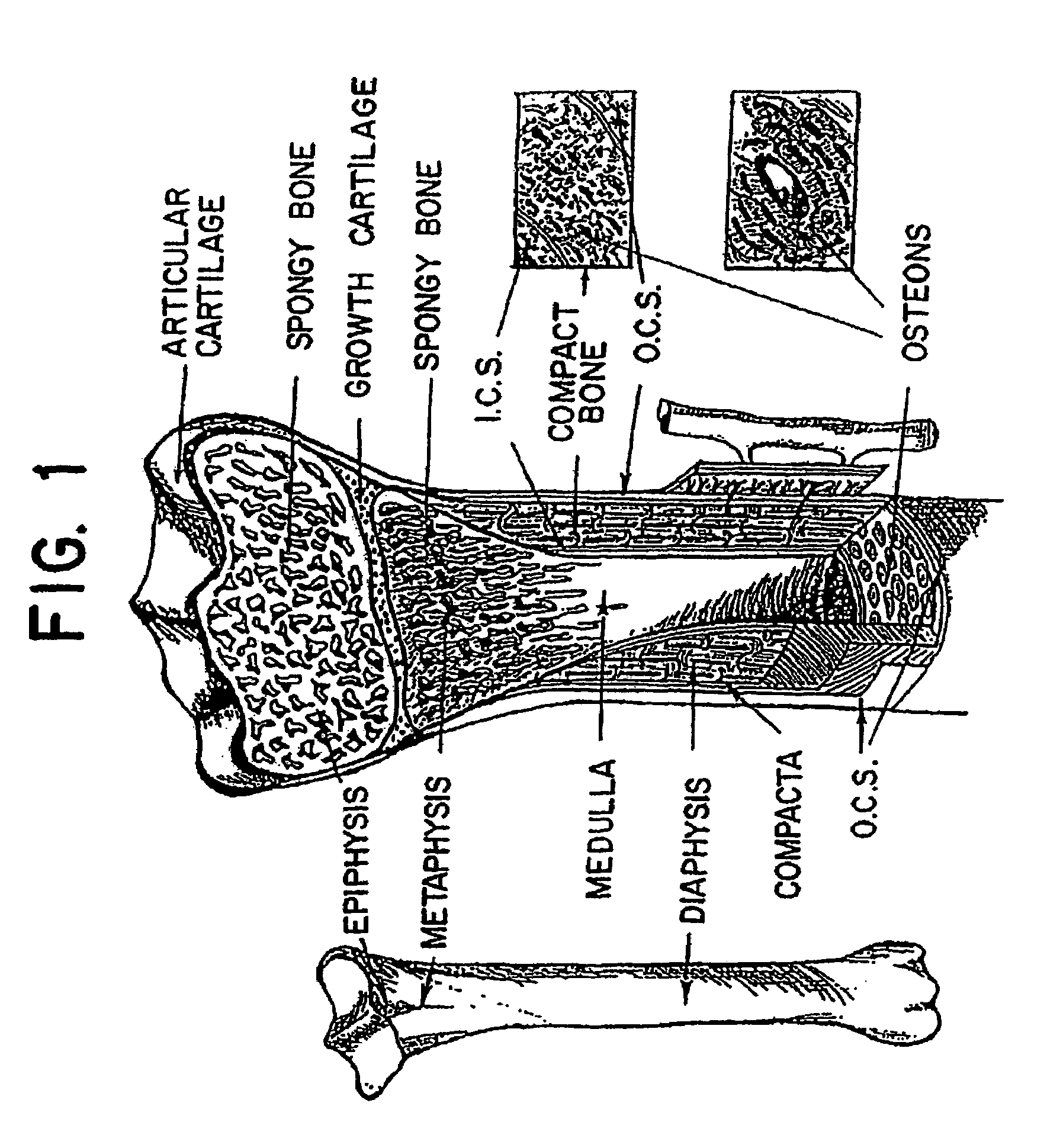 Method and system for modeling bone structure
