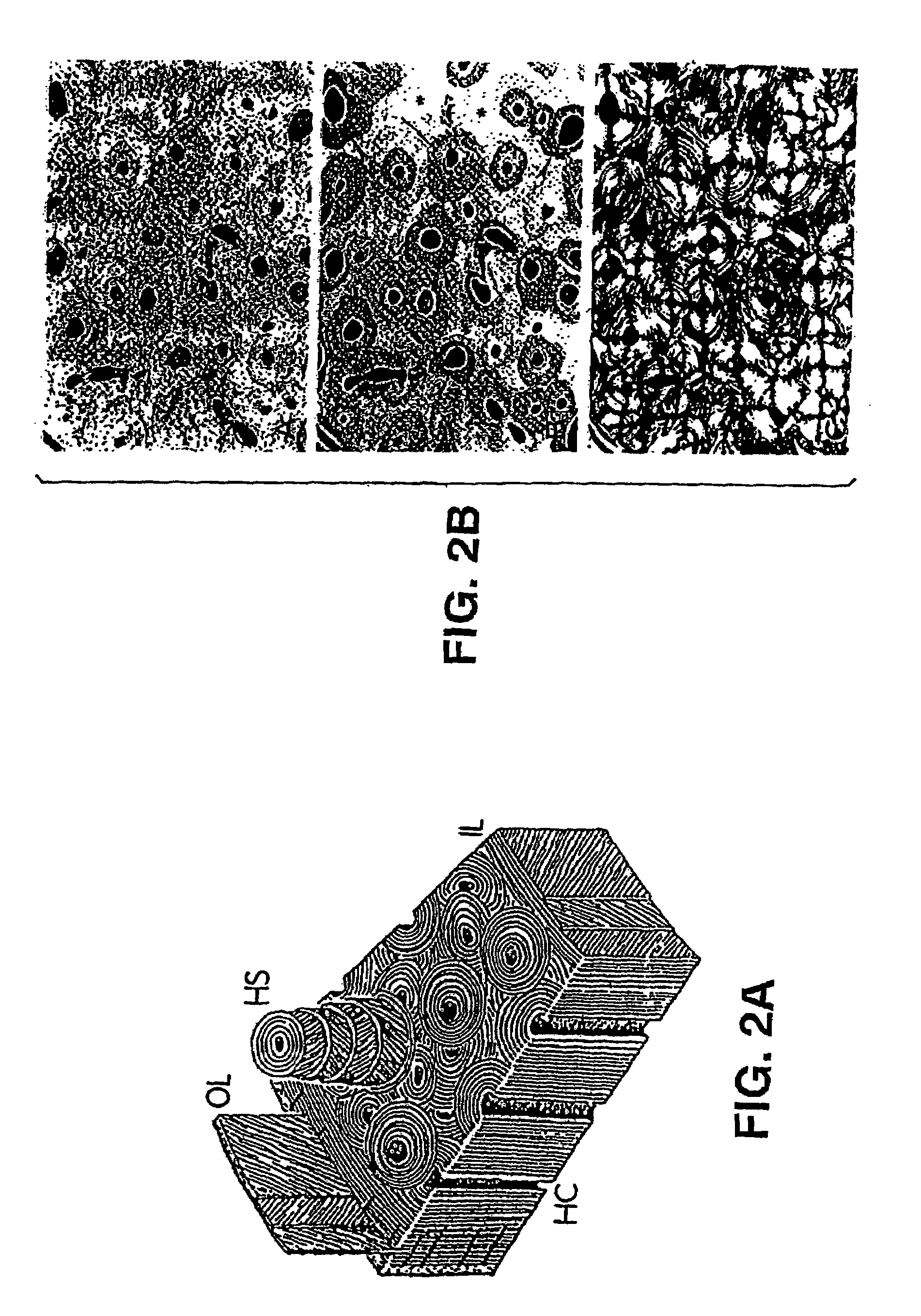 Method and system for modeling bone structure