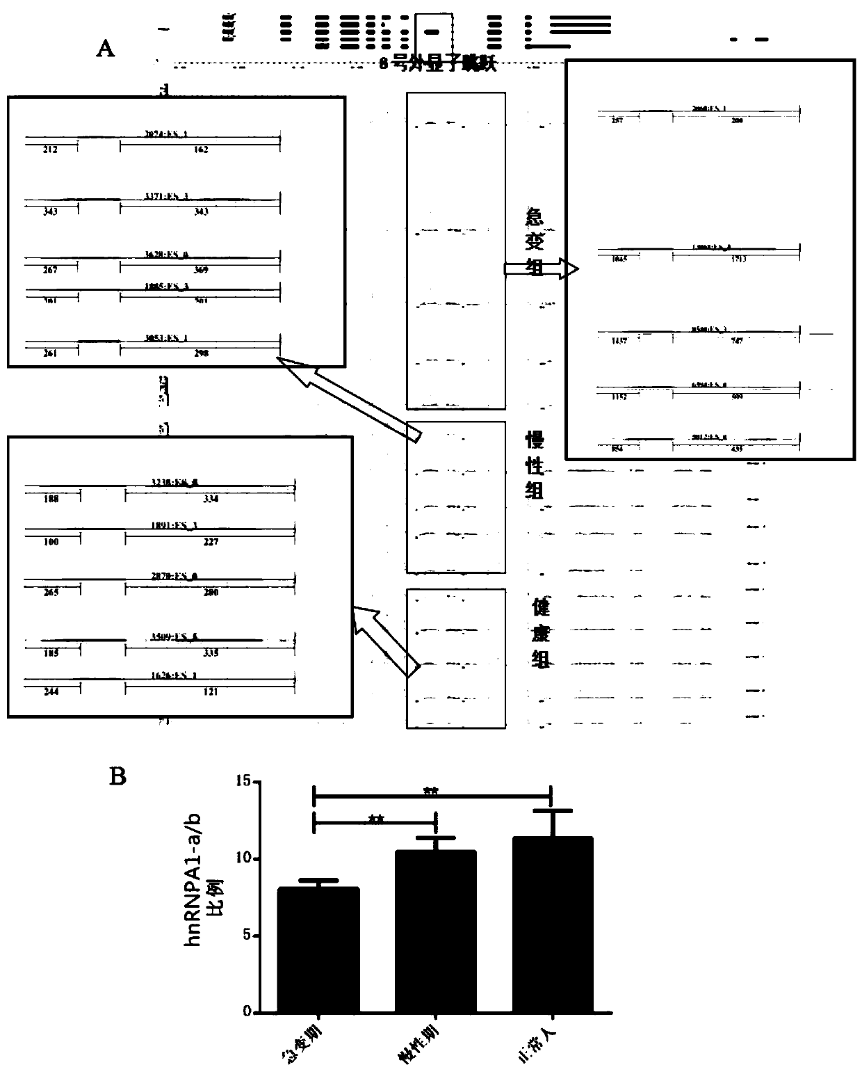 Reagent and kit for diagnosing CML blast phase based on hnrnpa1 splice variant