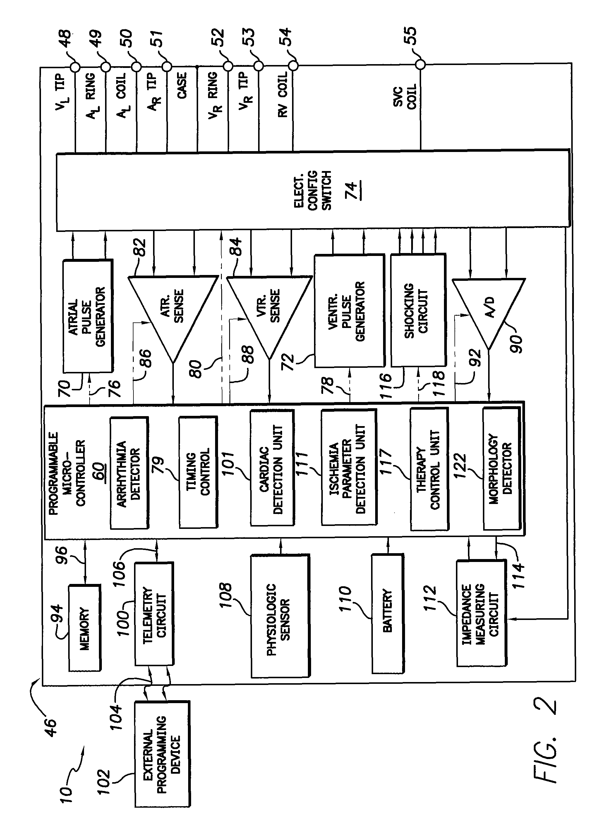 Method and system for automatically calibrating ischemia detection parameters