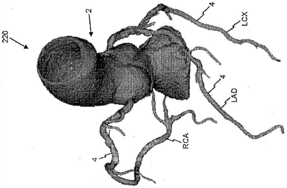Systems and methods for numerically evaluating vasculature