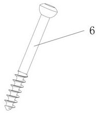 Anatomical sternoclavicular joint bone fracture plate and fixation system in sternoclavicular joint