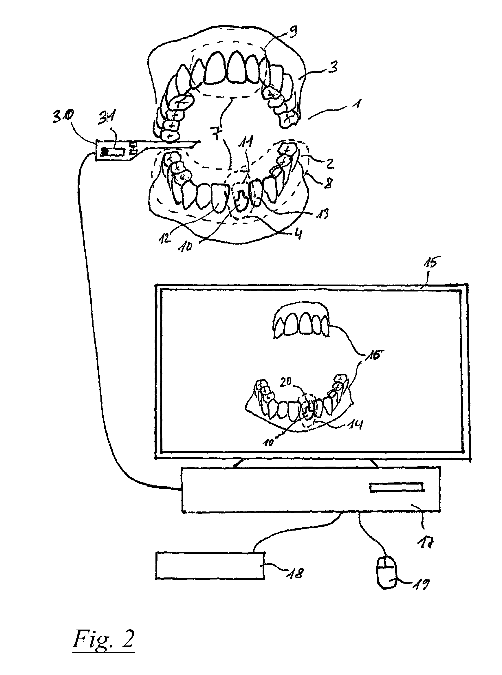 Method for the optical three-dimensional measurement of a dental object