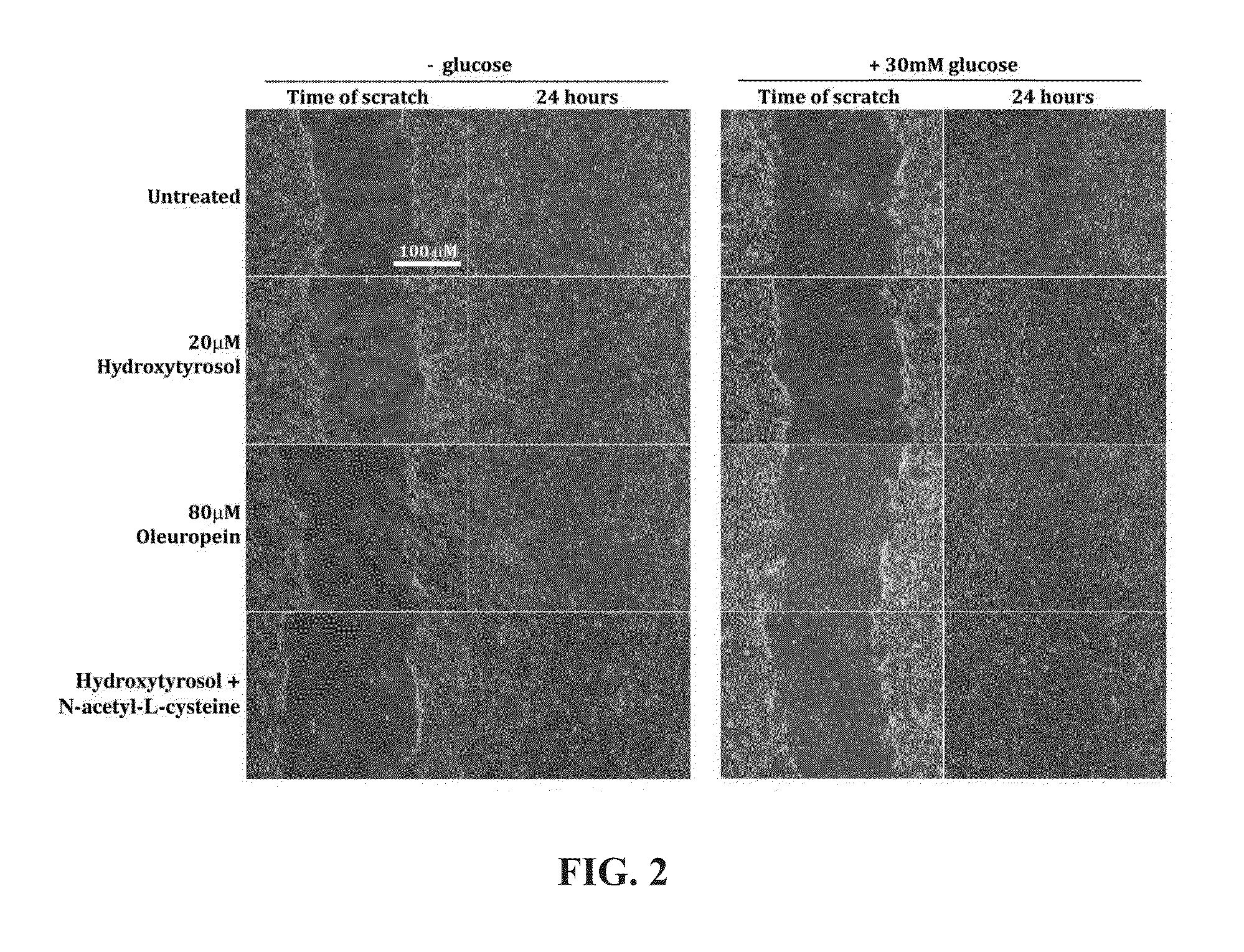 Methods for improved wound closure employing olivamine and human umbilical vein endothelial cells