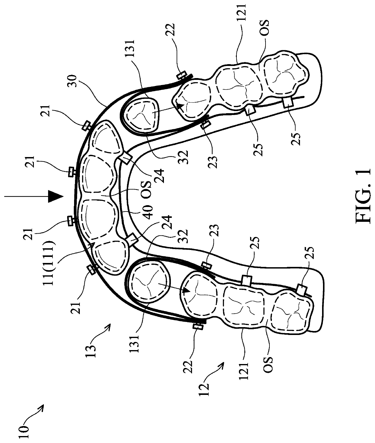 Orthodontic space closure device