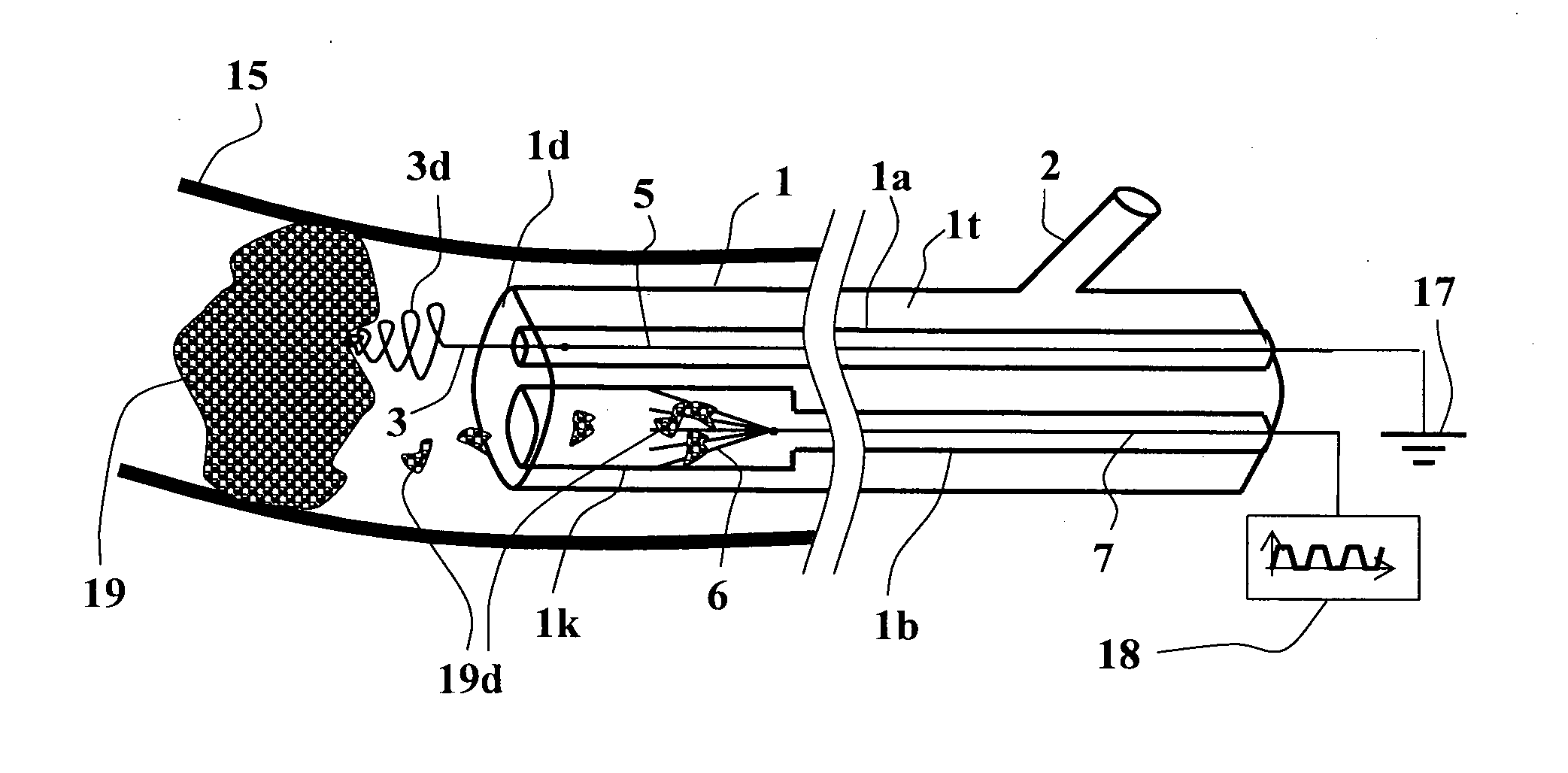 Method and apparatus for thrombus dissolution/thrombectomy by an electrode catheter device