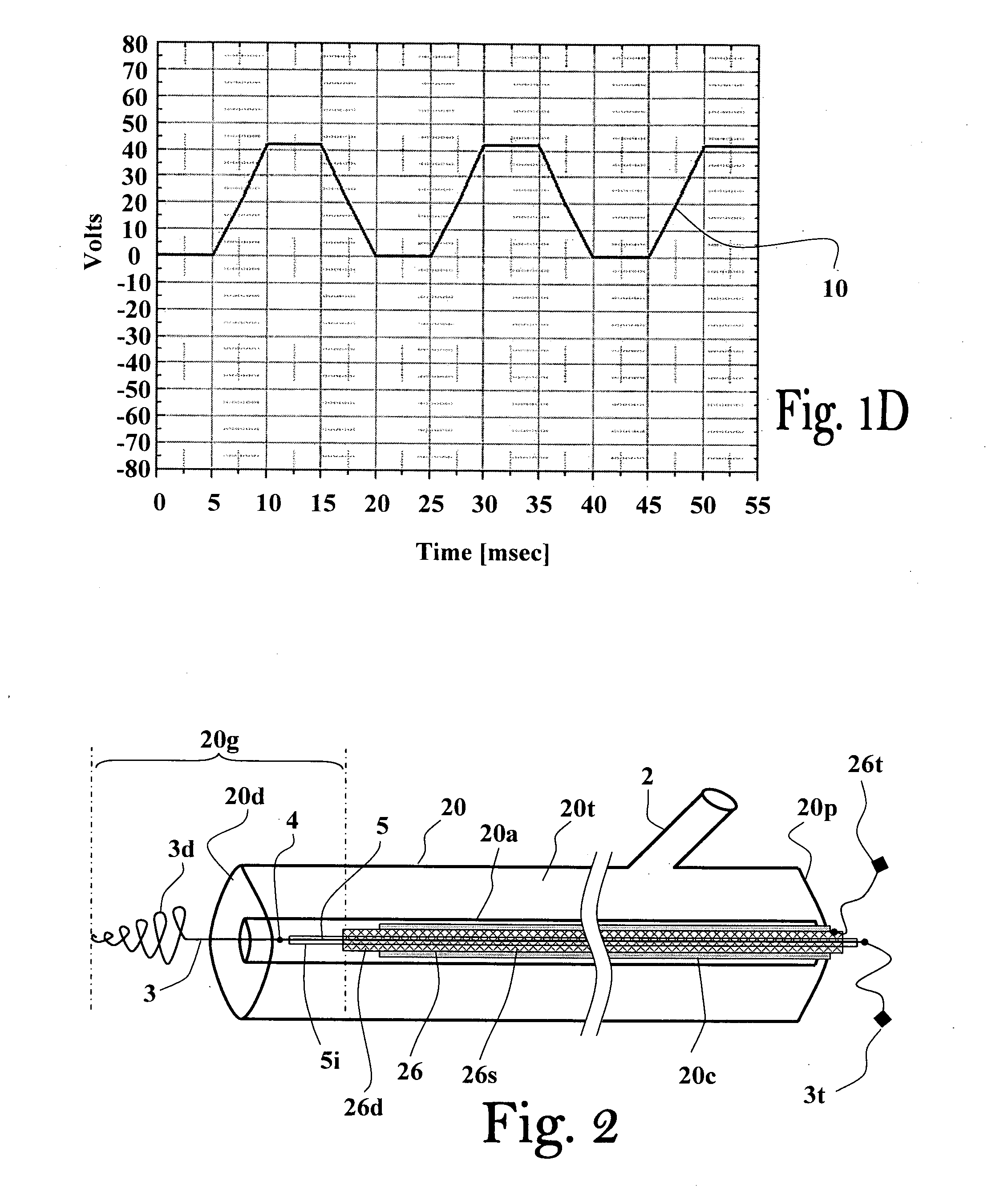 Method and apparatus for thrombus dissolution/thrombectomy by an electrode catheter device