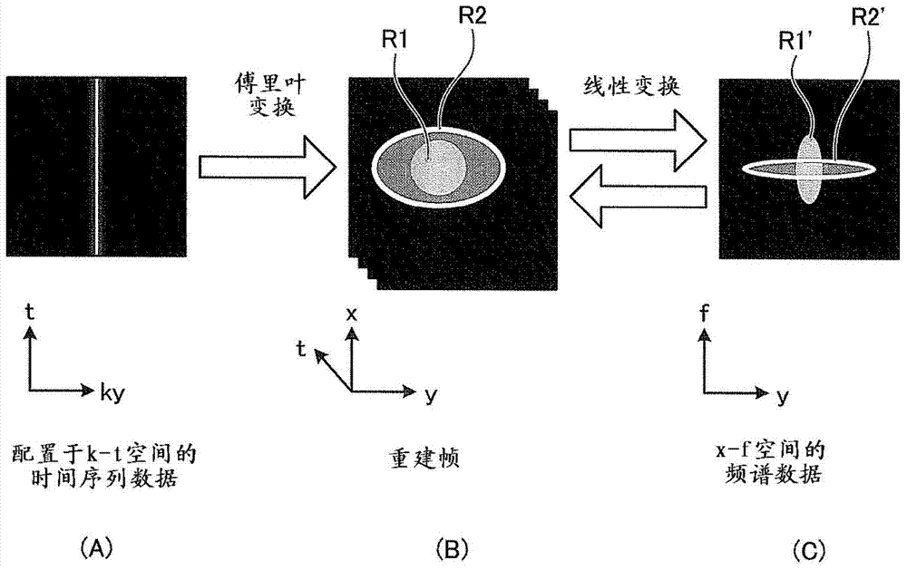 Magnetic resonance imaging device and image processing device