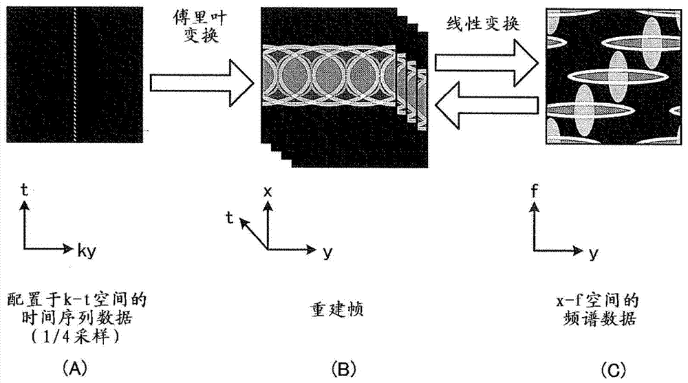 Magnetic resonance imaging device and image processing device