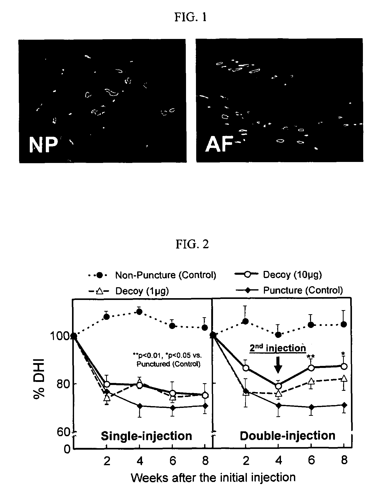 Methods and compositions for treating, inhibiting and reversing disorders of the intervertebral disc