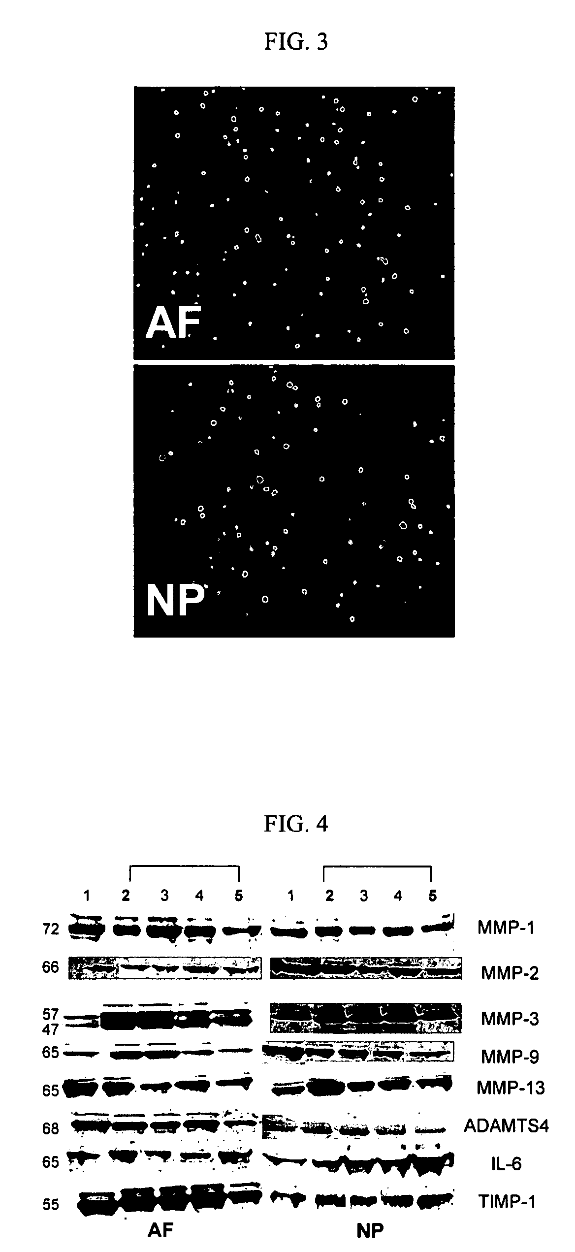 Methods and compositions for treating, inhibiting and reversing disorders of the intervertebral disc