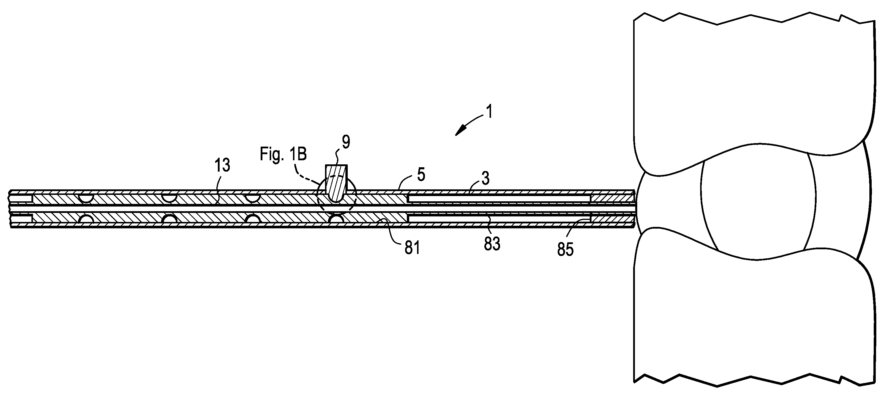Intervertebral Disc Puncture and Treatment System