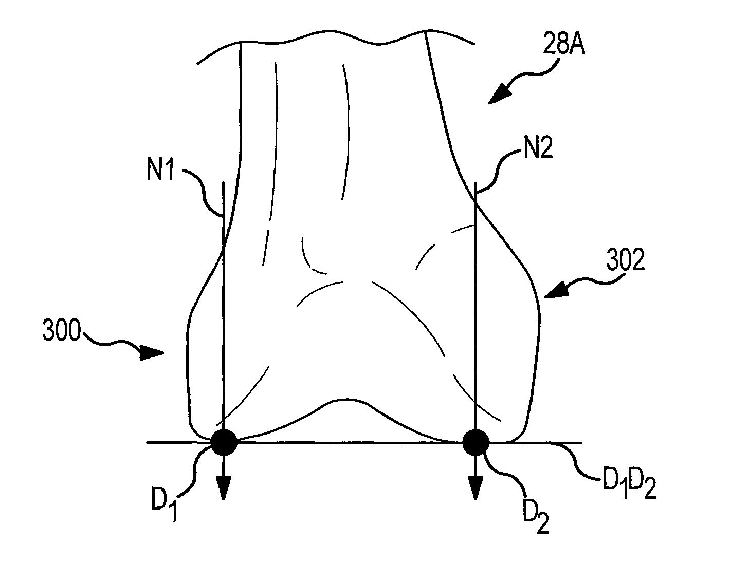 Generation of a computerized bone model representative of a pre-degenerated state and useable in the design and manufacture of arthroplasty devices