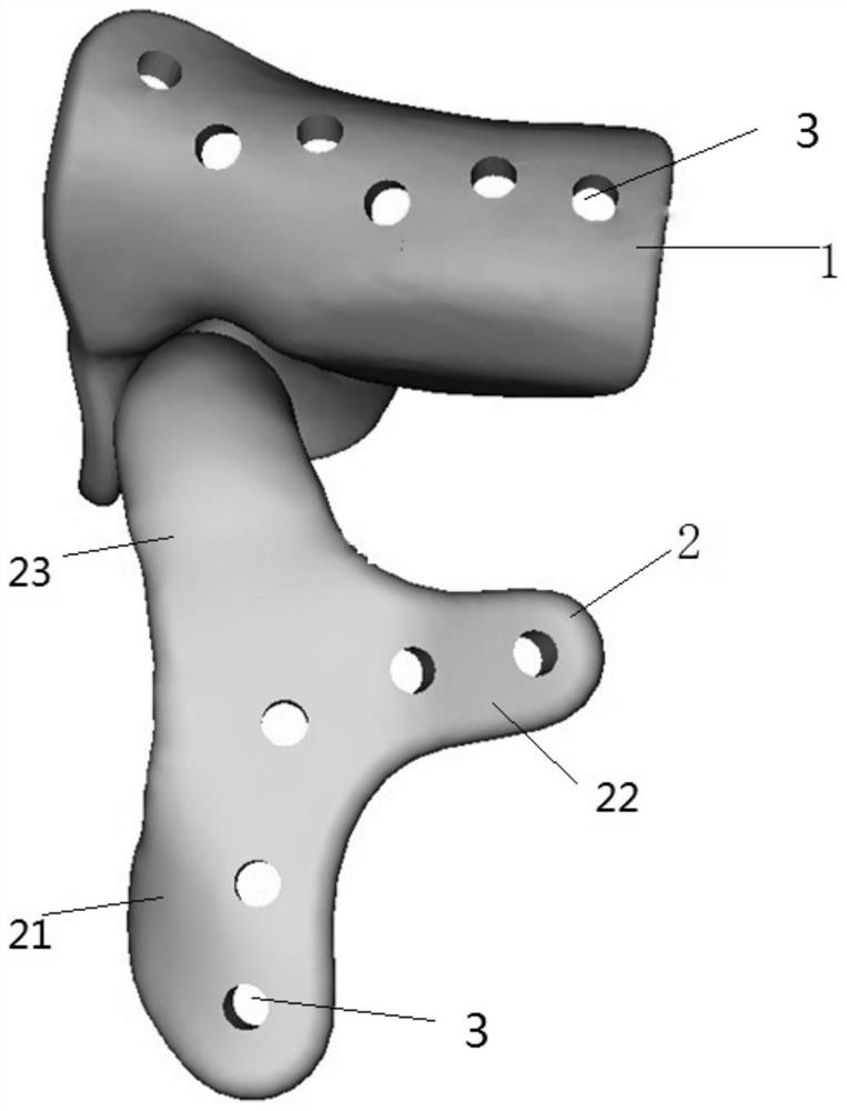 Muscle function preservation type all-temporal lower joint prosthesis