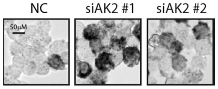 Application of AK2 gene in preparation of leukemia induced differentiation treatment medicine