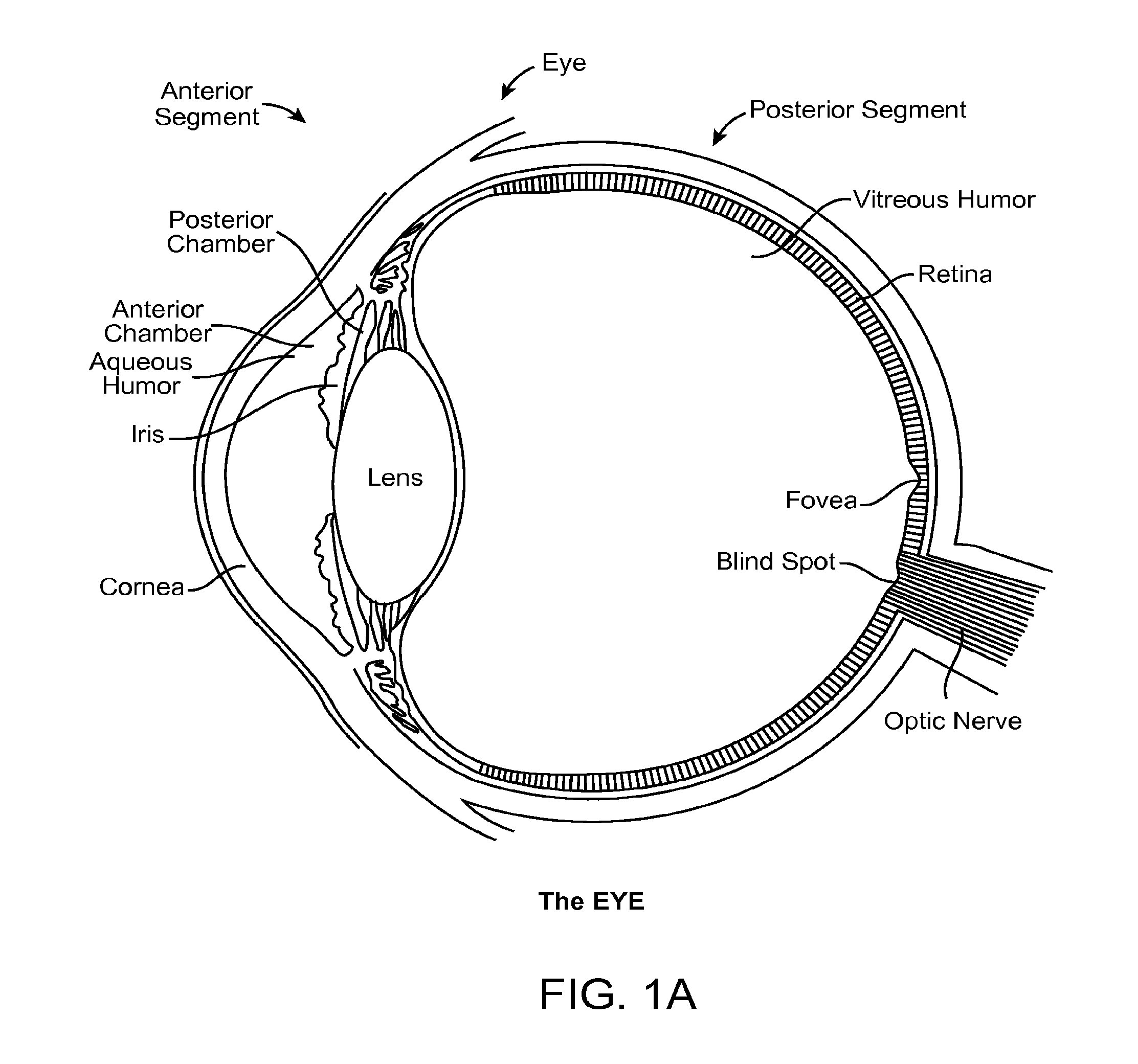 Implantable MEMS intraocular pressure sensor devices and methods for glaucoma monitoring